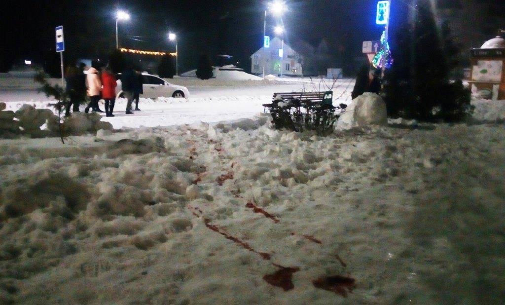 Стрілянина на Житомирщині