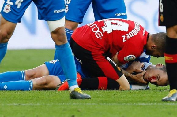 Травма игрока депортиво видео Травма игрока депортиво видео