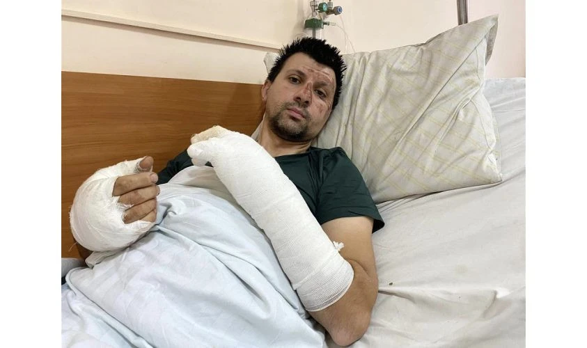 чоловік з опіками