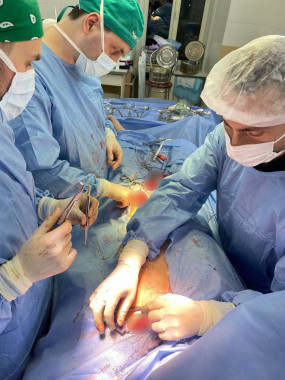 Лікарі у Львові врятували пацієнта з гігантською аневризмою