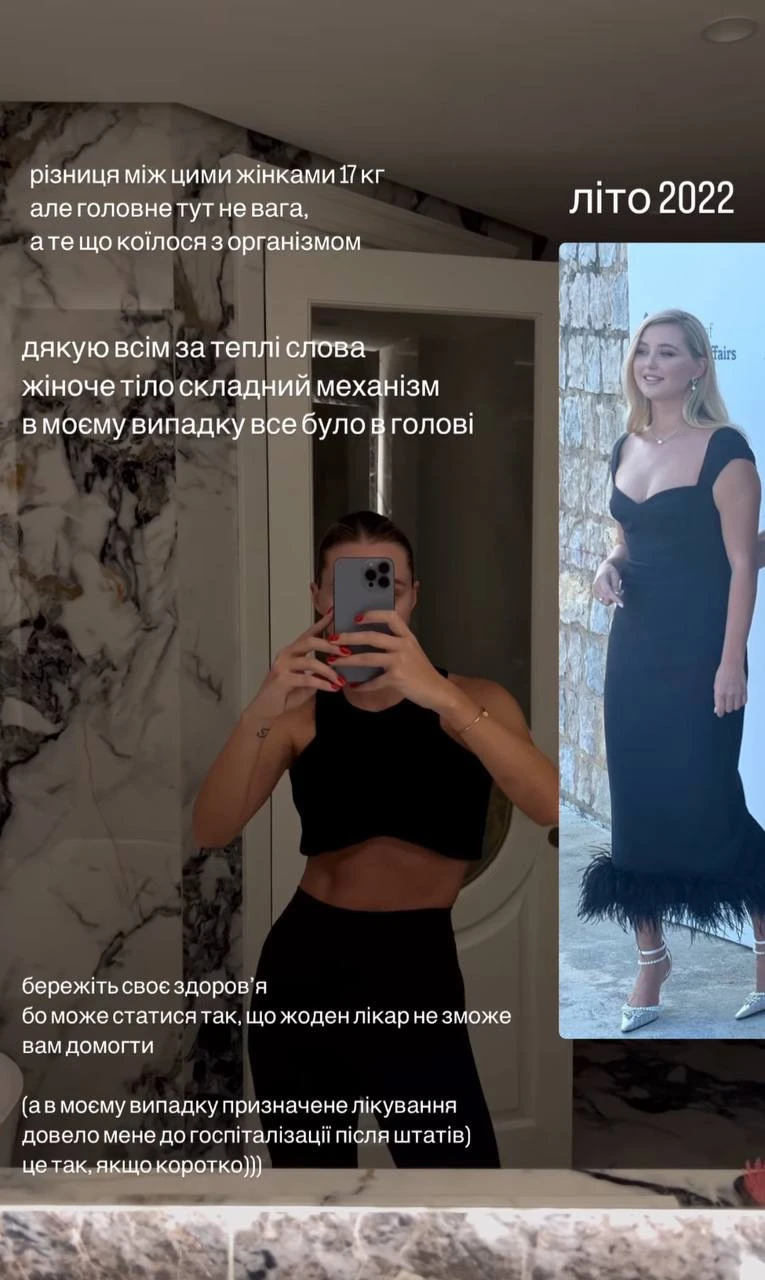 На фото:дружина Тищенка показала, як виглядала через стрес