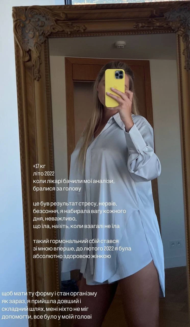 На фото:дружина Тищенка показала, як виглядала через стрес