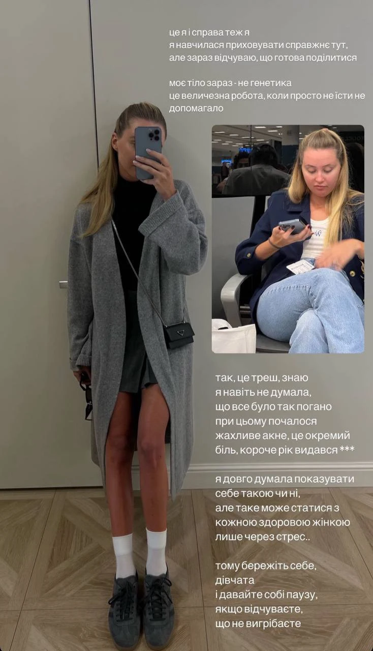На фото:дружина Тищенка показала, як виглядала через стрес