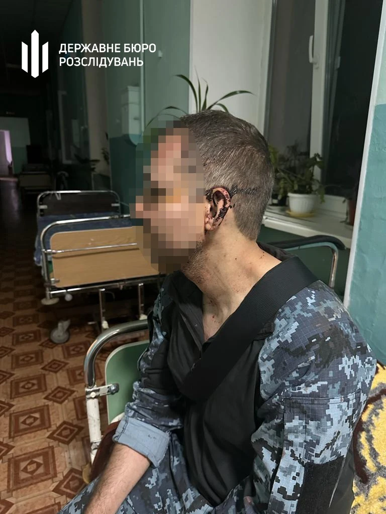 У військовій частині на Одещині побили військовослужбовця