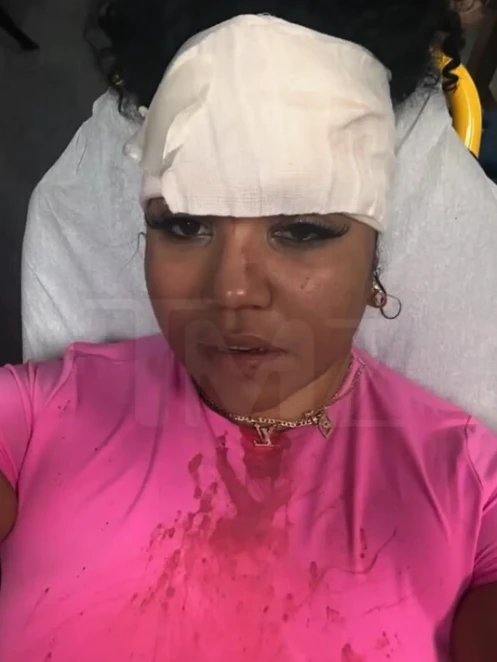 На фото: Бріана Монегейн, постраждала від удару мікрофоном від 50 Cent