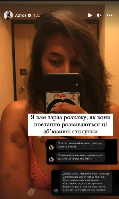 На фото: Анна Неплях розповіла про домашнє насильство