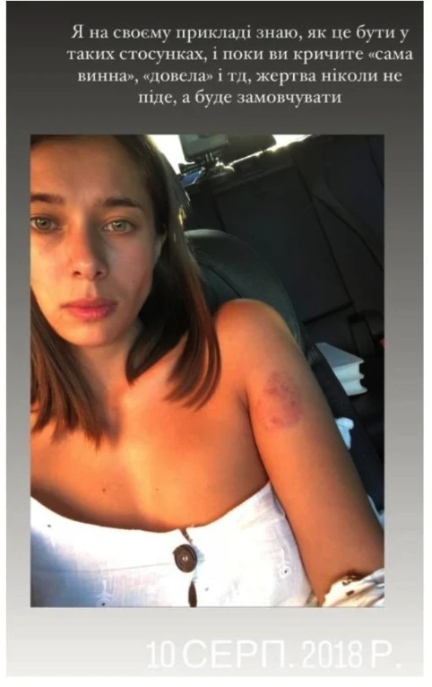 На фото: Анна Неплях розповіла про домашнє насильство