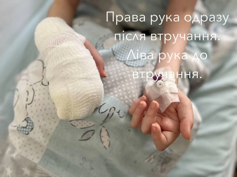 У Львові прооперували 16-річну дівчину з Донеччини з рідкісним генетичним захворюванням
