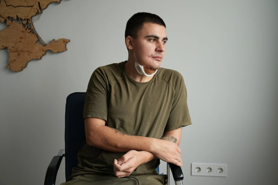 У Львові 25-річному захиснику сформували щелепу з гомілкової кістки