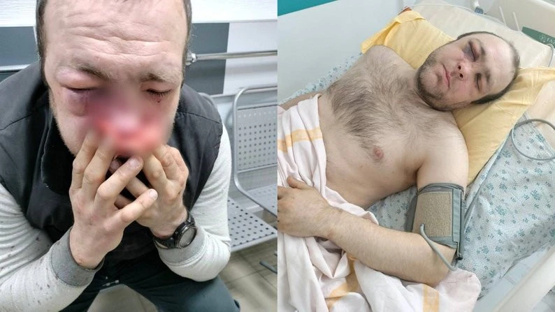 Орест Паньків у лікарні