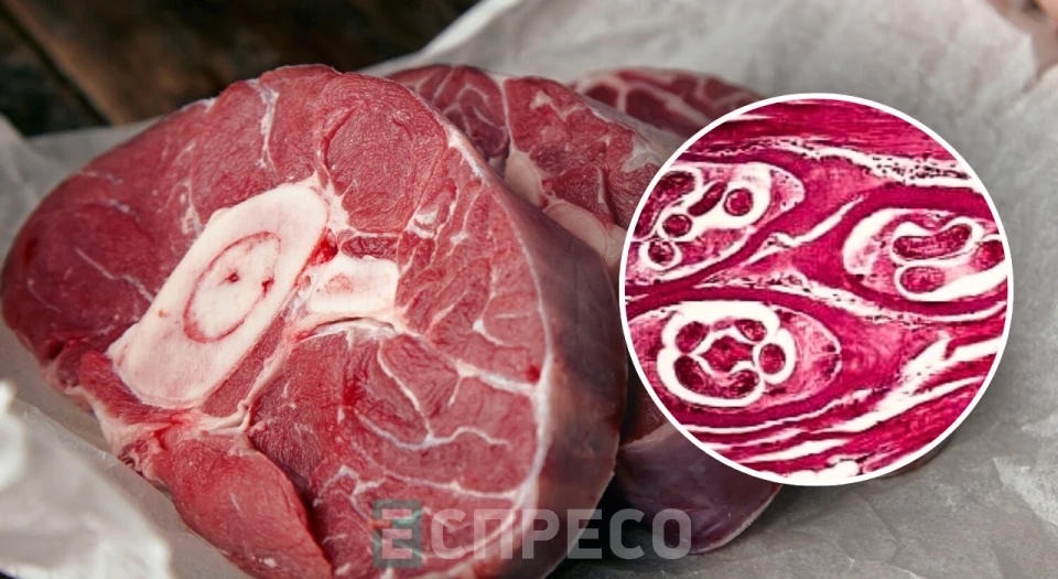 колаж мясо хвороба