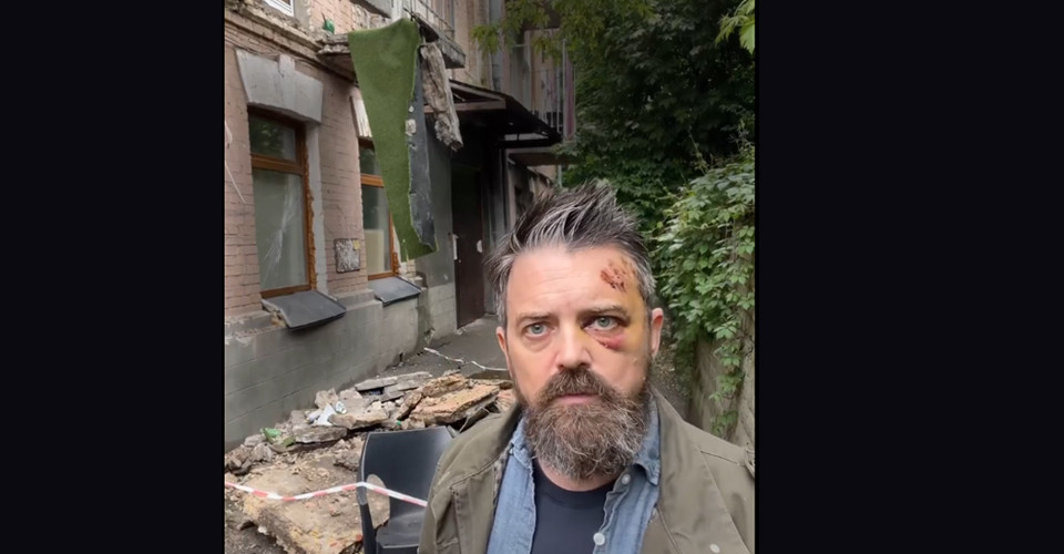 на американця обвалився балкон