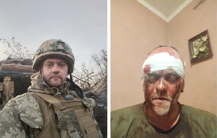 Поліція перевіряє інформацію про побиття ветерана в Пустомитах на Львівщині